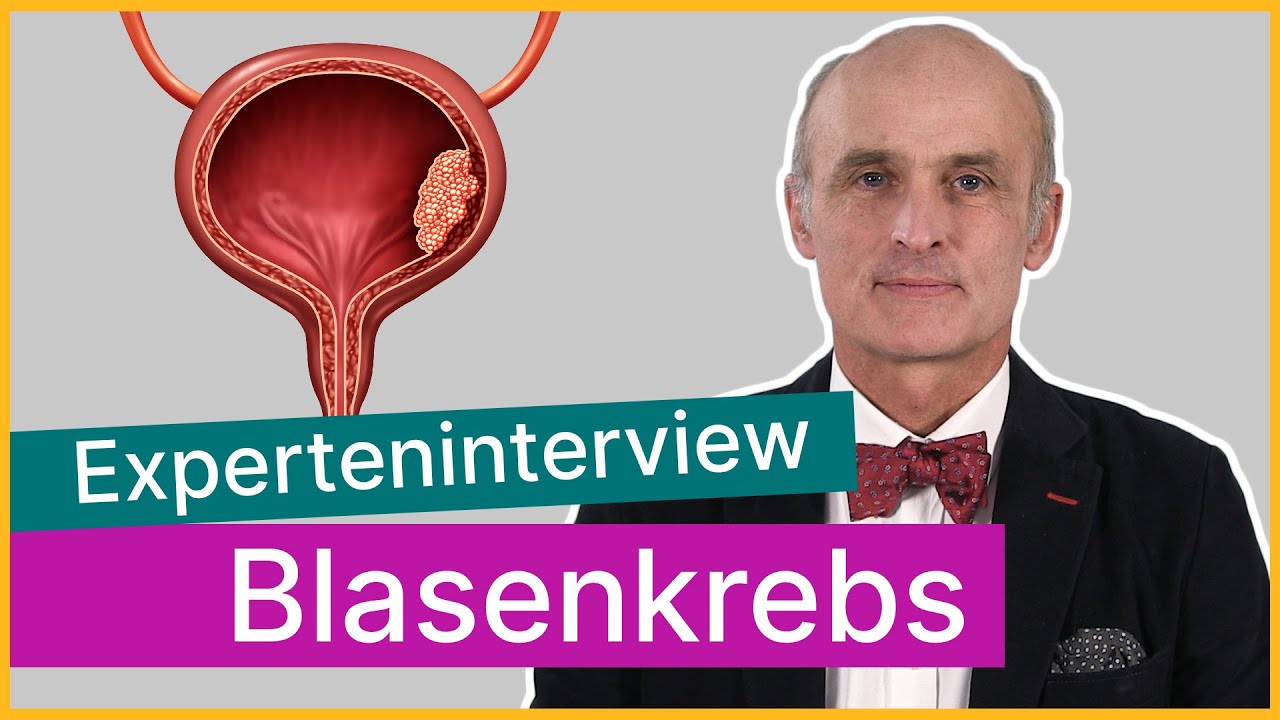 Blasenkrebs: Dafür kann sich der Patient entscheiden! | Asklepios