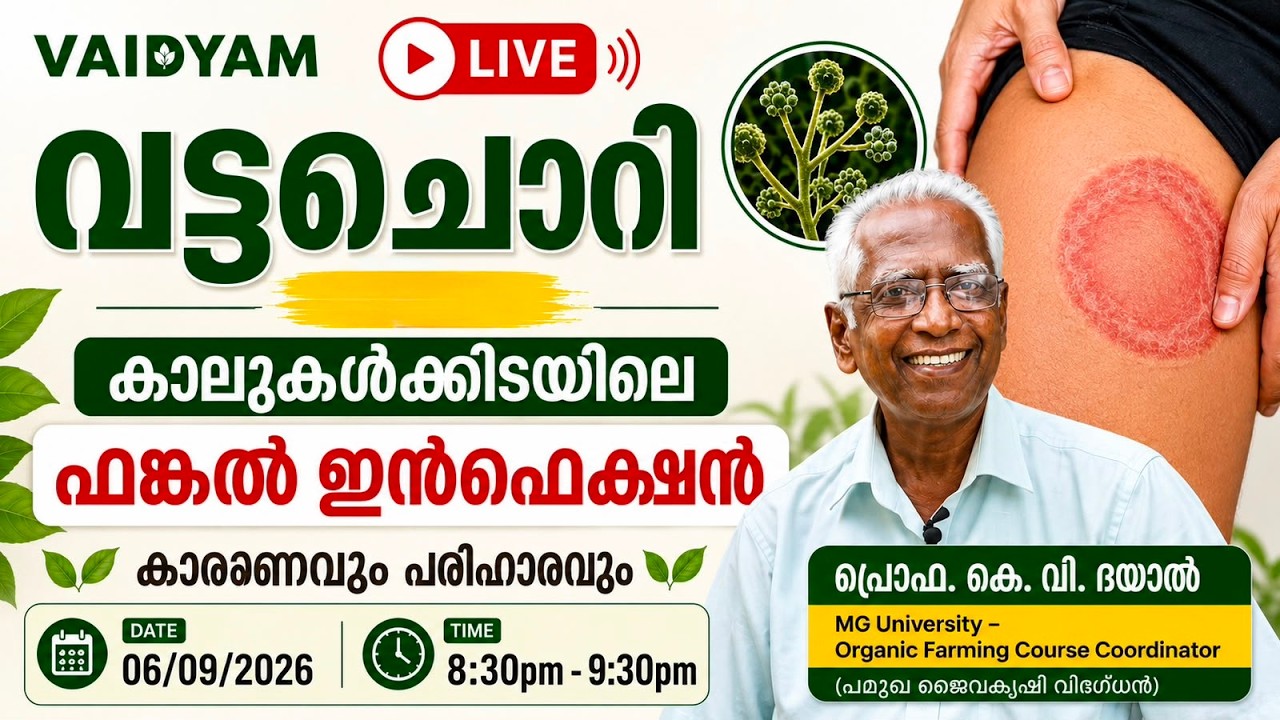 വട്ടച്ചൊറി അഥവ കാലുകൾക്കിടയിലെ ഫങ്കൽ ഇൻഫെക്ഷൻ കാരണവും പരിഹാരവും #malayalam #kvdayal #livestream