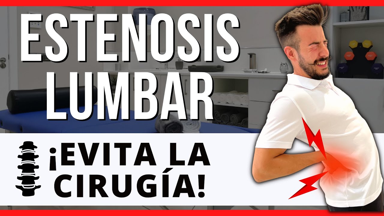 Top 7 Ejercicios Efectivos para Mejorar la Estenosis Canal Lumbar y sus posiciones de Alivio.