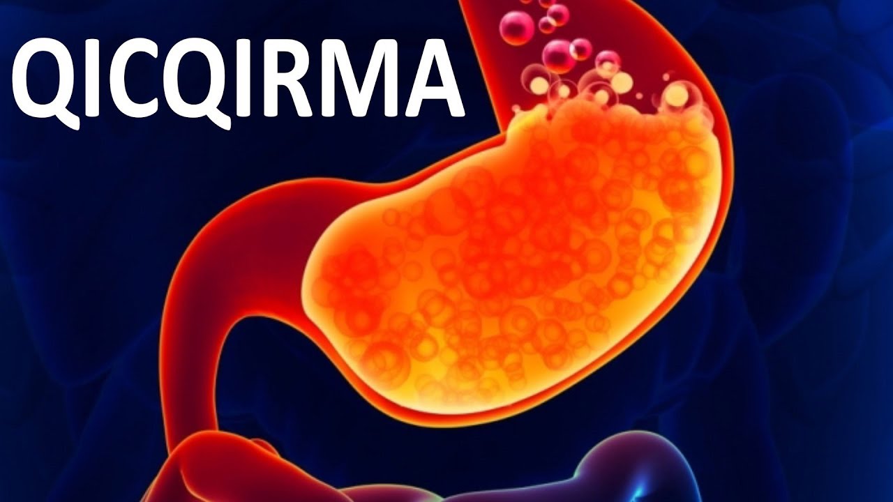Qıcqırma NECƏ müalicə olunur?