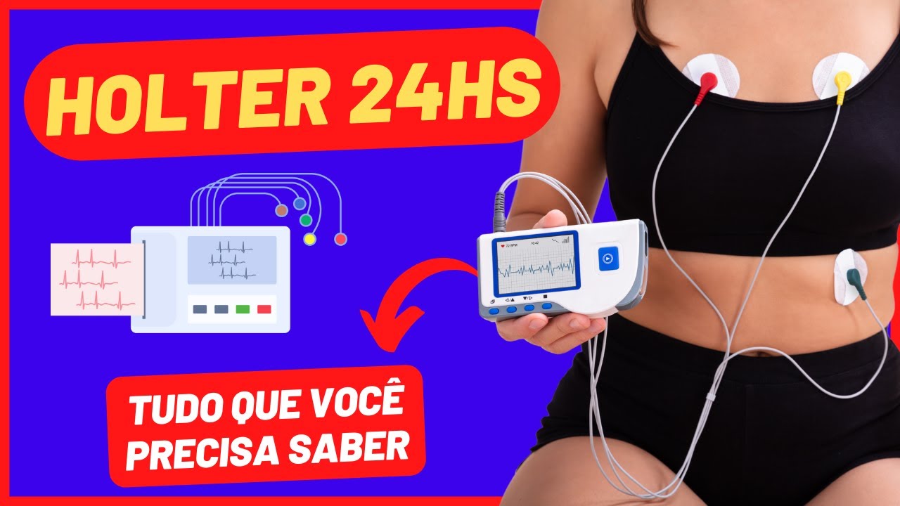 EXAME DE HOLTER 24 HORAS | O QUE É | PARA QUE SERVE | COMO DEVE SER REALIZADO | EXAME DE LOOPER