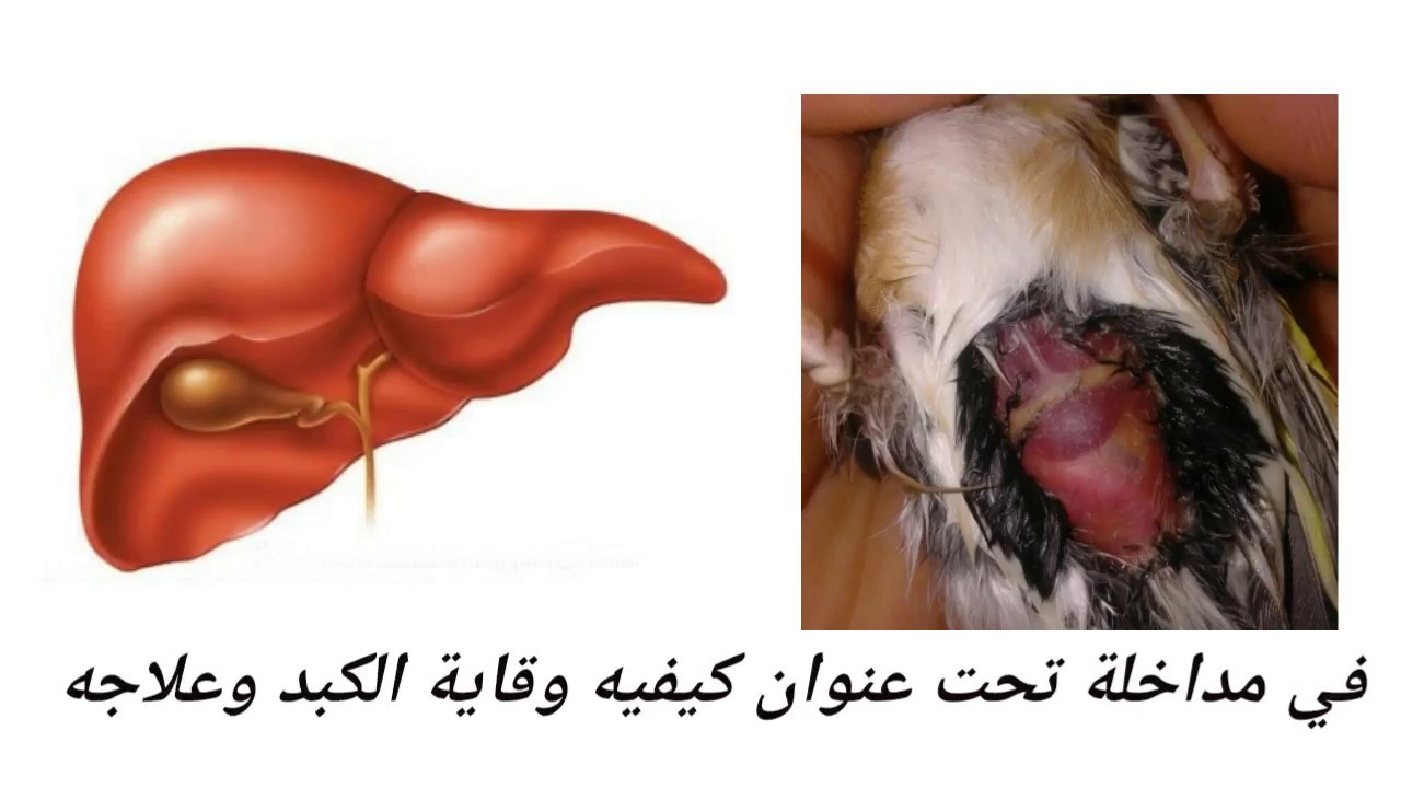 كيفية وقاية وعلاج الكبد بالمواد الطبيعة