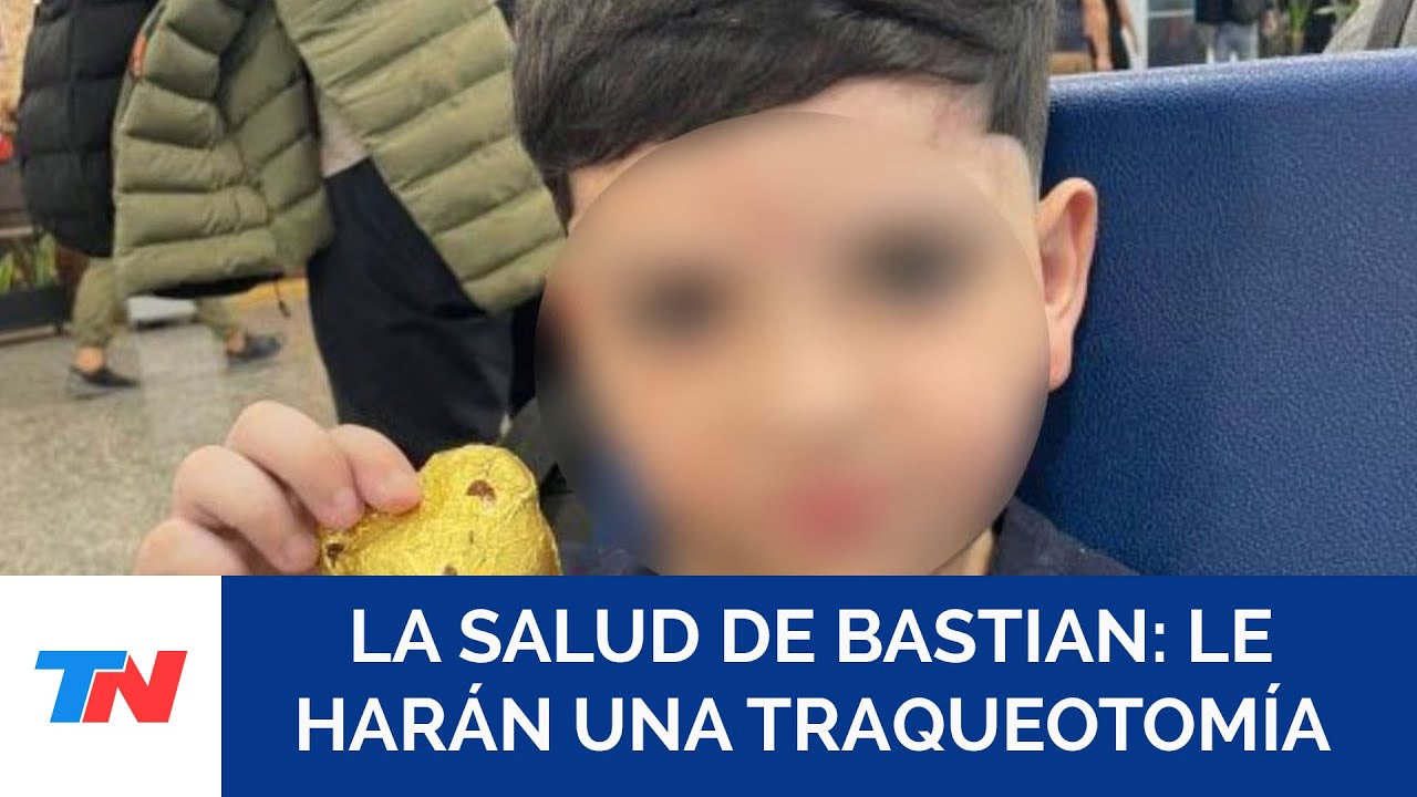 El nene de 8 años que sufrió un accidente en Pinamar sigue grave y le harán una traqueotomía