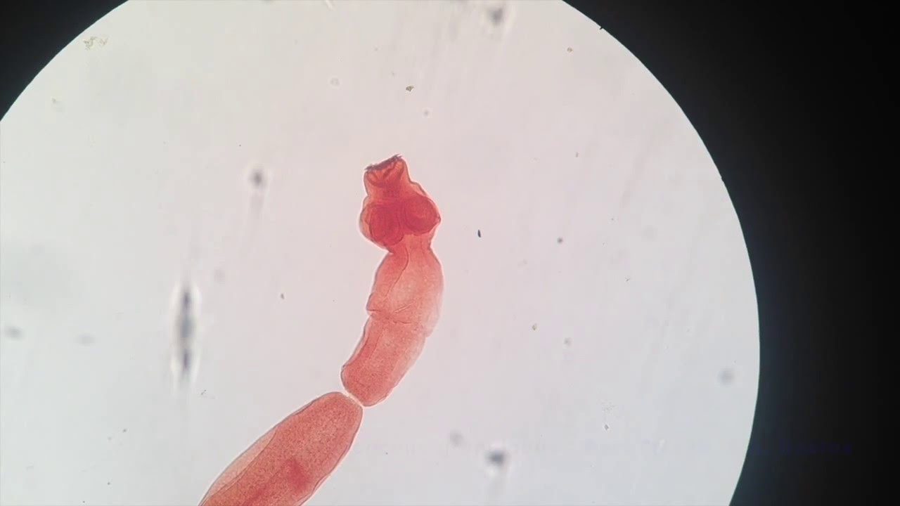 Echinococcus granulosus