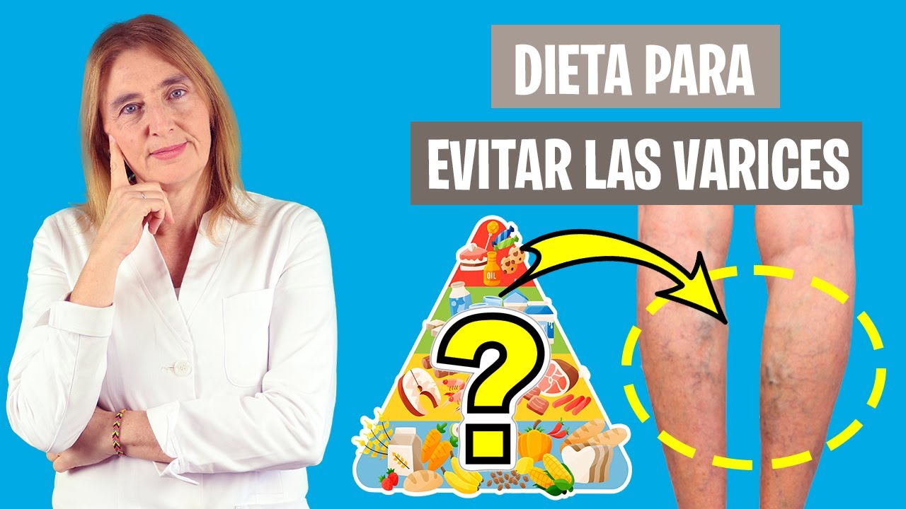 La DIETA PERFECTA CONTRA las VARICES | Estos alimentos mejorarán tus varices | Nutrición clínica