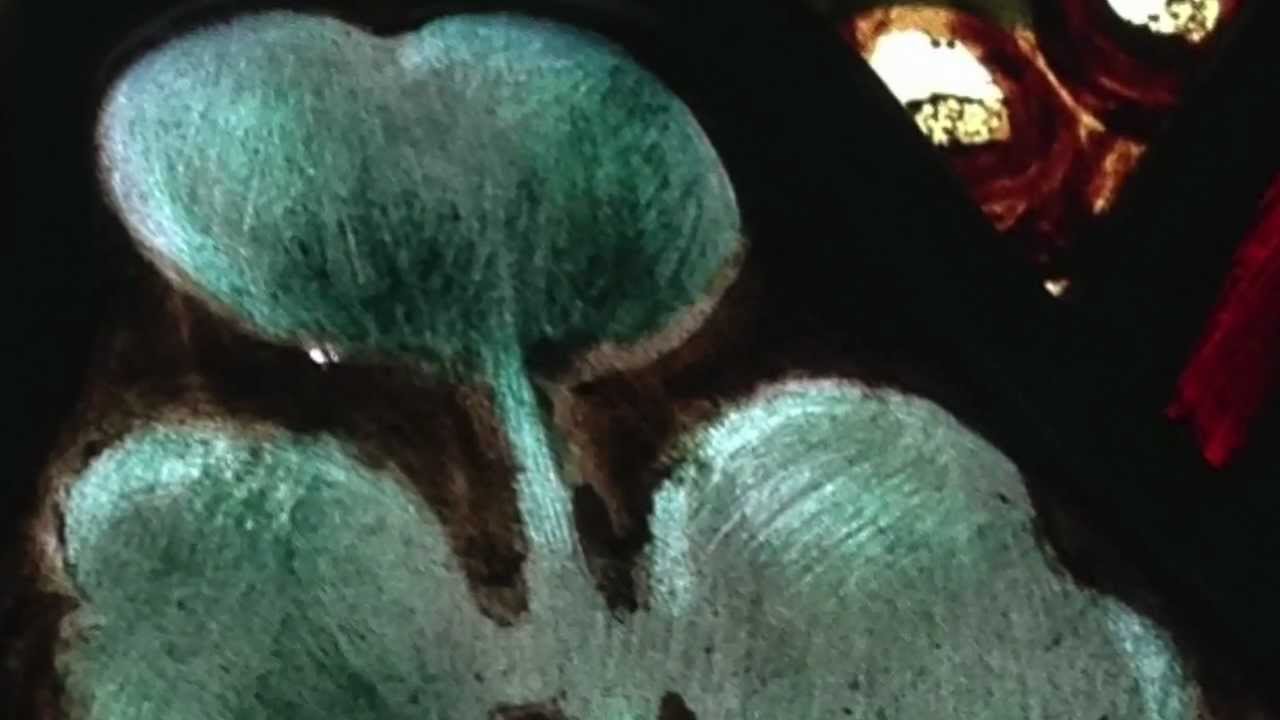 Saint Patrick - The Irish Saint