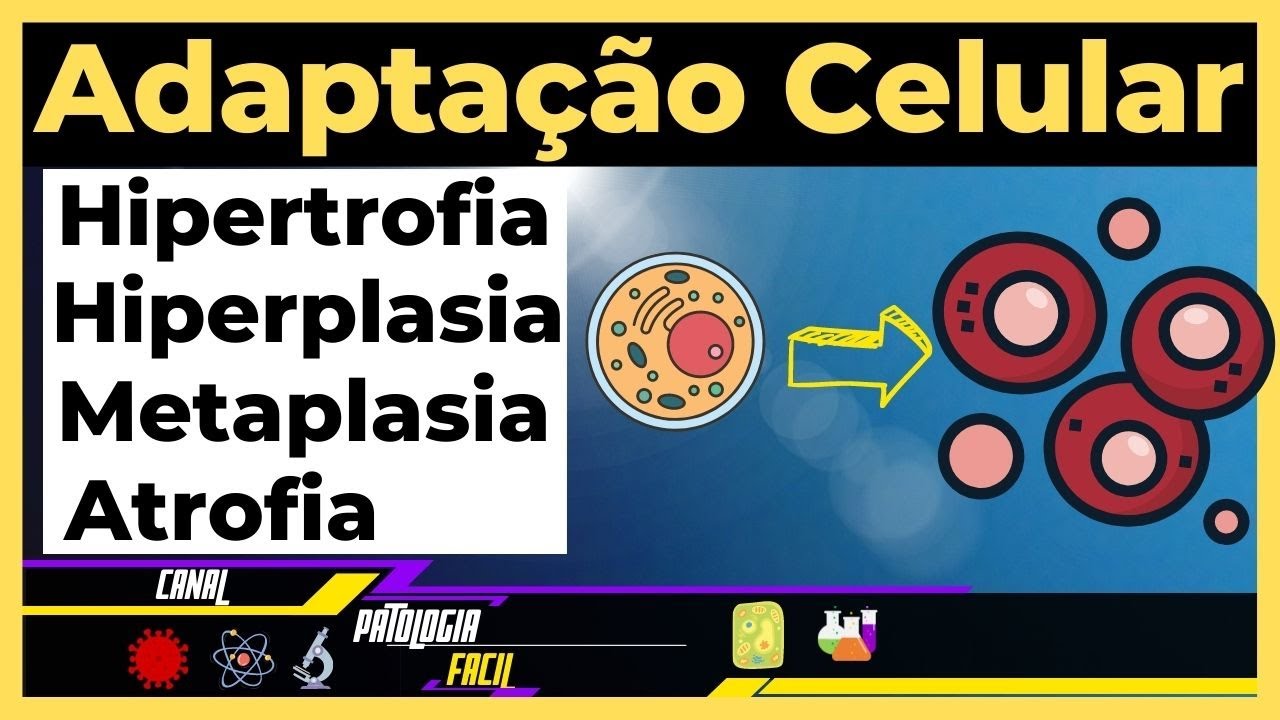 Adapta&ccedil;&otilde;es celulares: Hipertrofia; Hiperplasia; Atrofia; Metaplasia [Atualizado]