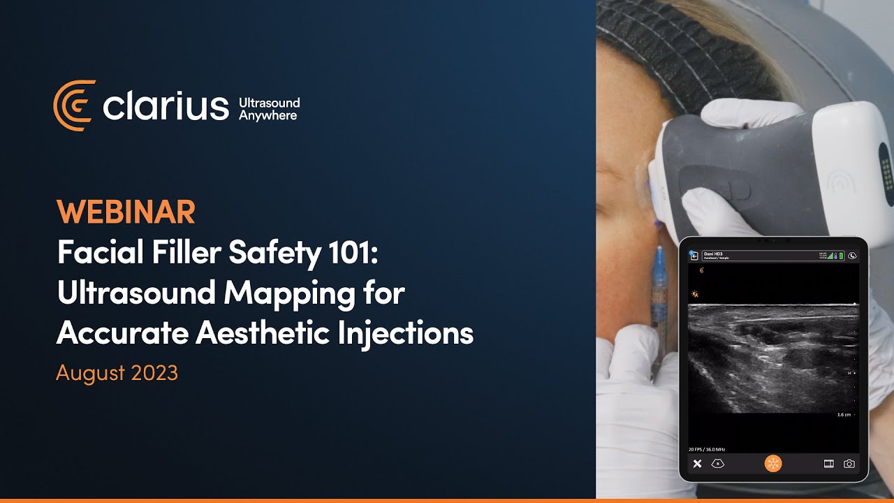 Facial Filler Safety 101: Ultrasound Mapping for Accurate Aesthetic Injections