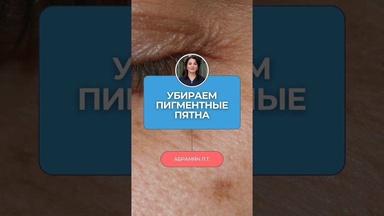 ✨ Один продукт  стирает пигментные пятна лучше лазера!