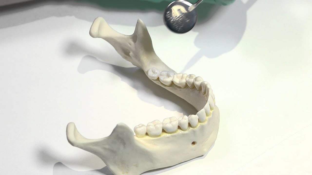 Dentistry Anaesthesia LTI   3   Mandibular Anaesthesia   Inferior Alveolar Nerve Block   Preclinical