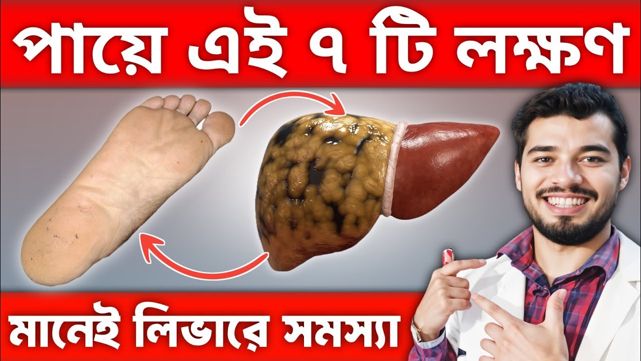 পায়ে এই ৭ টি লক্ষণ দেখলে বুঝবেন লিভার নষ্ট হচ্ছে | Liver Disease Symptoms in Foot