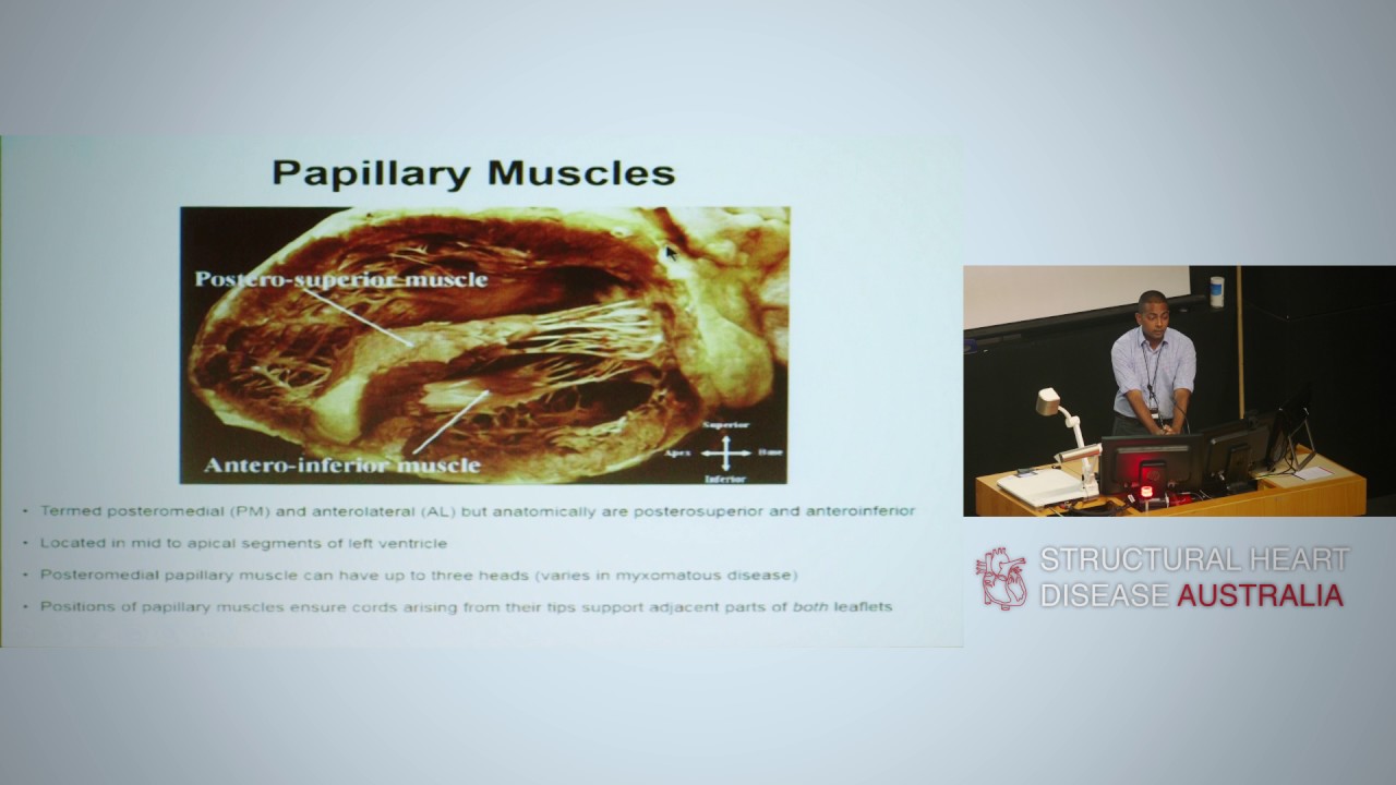 Anatomy and pathologies of the mitral valve - Dr Sean Lal