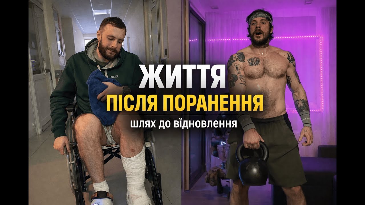ЖИТТЯ ПІСЛЯ ПОРАНЕННЯ | Мій шлях реабілітації та тренувань