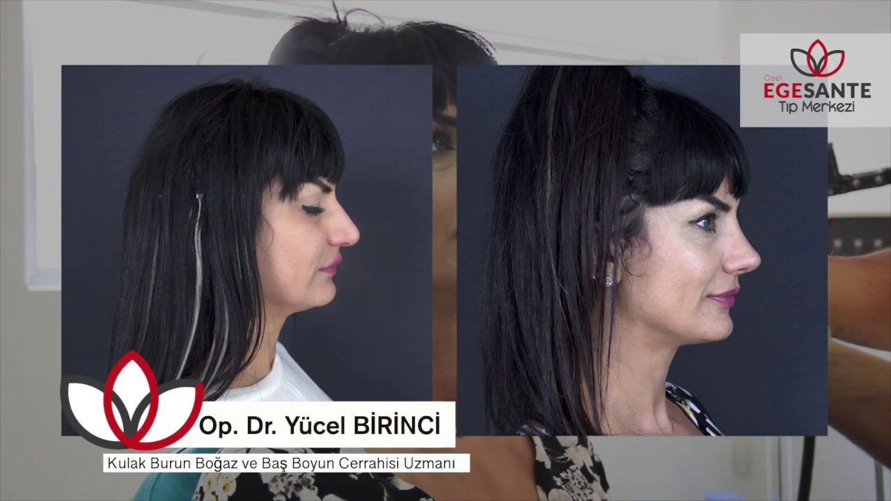 İzmir Burun Estetiği (Rinoplasti) | OP. DR. Yücel BİRİNCİ