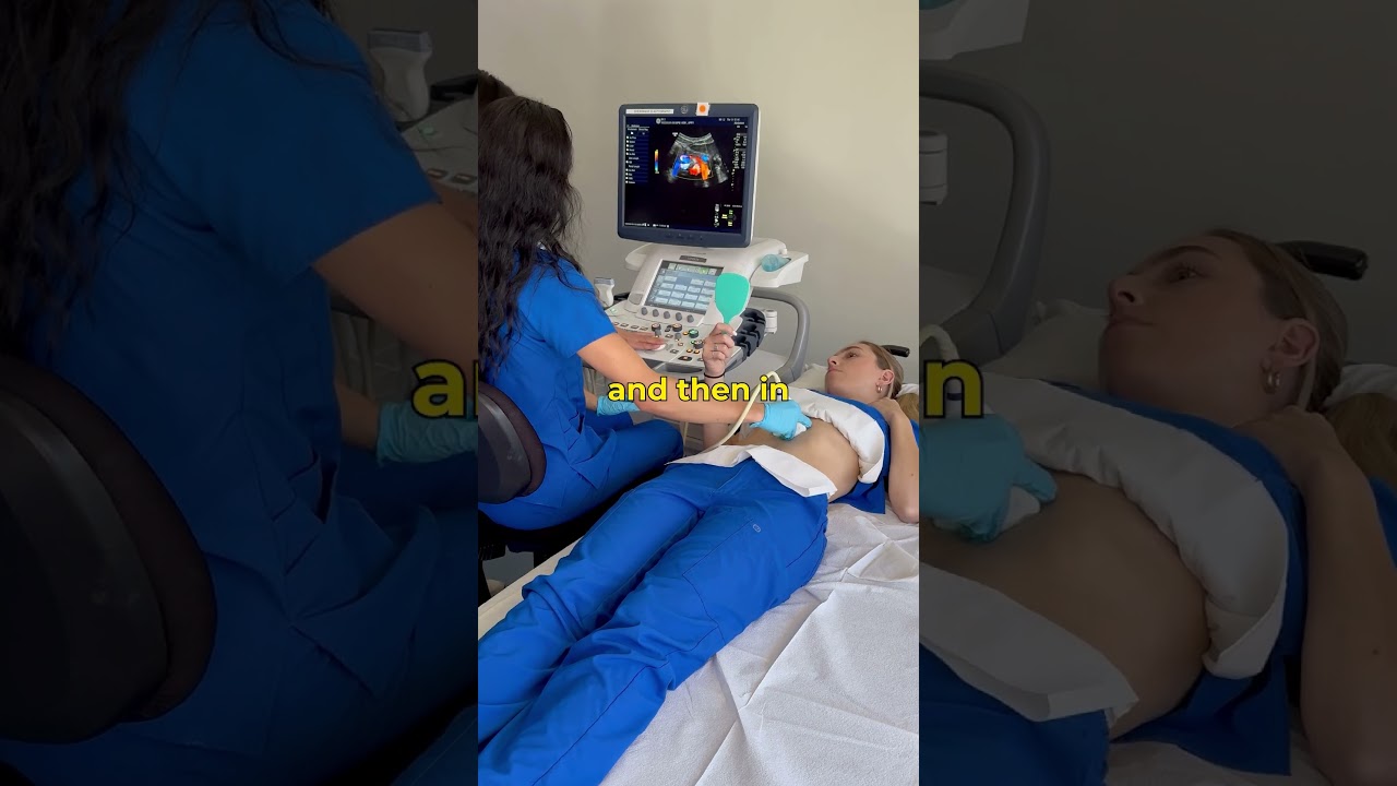 Is that My Pancreas!? Interpret a Live Ultrasound Scan with Us! 🖥️ #ultrasound #letslearn
