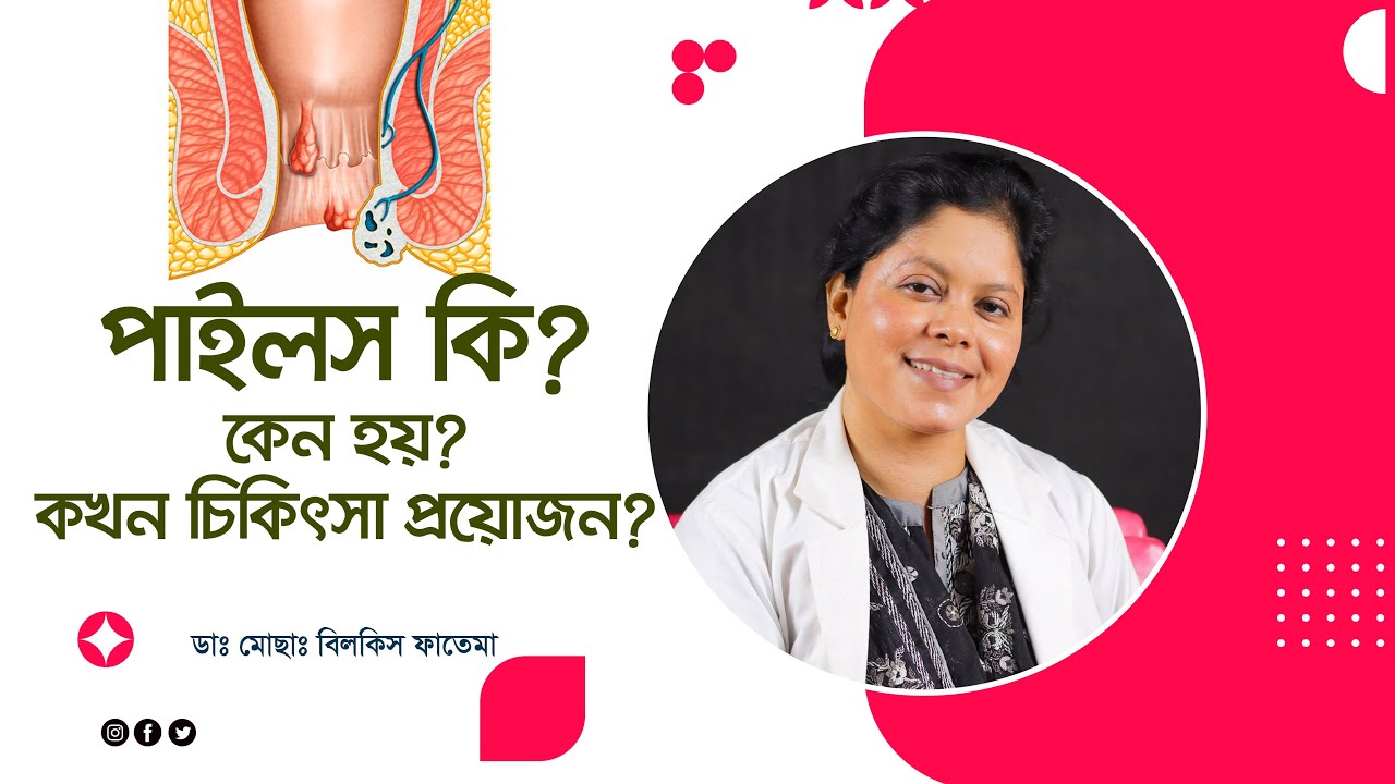 পাইলস কী? কেন হয় এবং এর চিকিৎসা | পাইলস এর ঘরোয়া উপায় | Dr. N. C. Saha | Piles Treatment