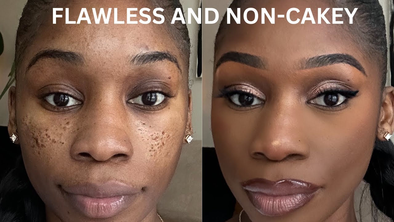 PITTED ACNE SCAR MAKEUP TUTORIAL STEP BY STEP (ICEPICK SCARS/BOXCAR SCARS/CRATERS)