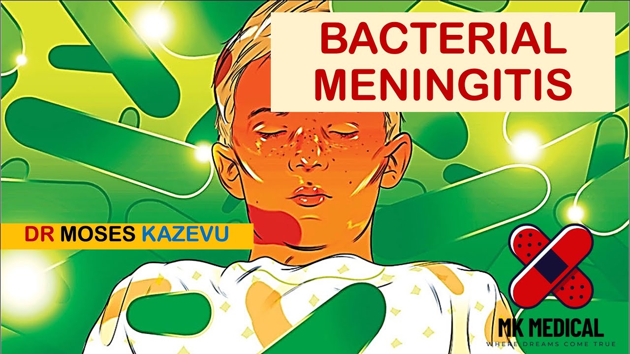 Бактериальный менингит