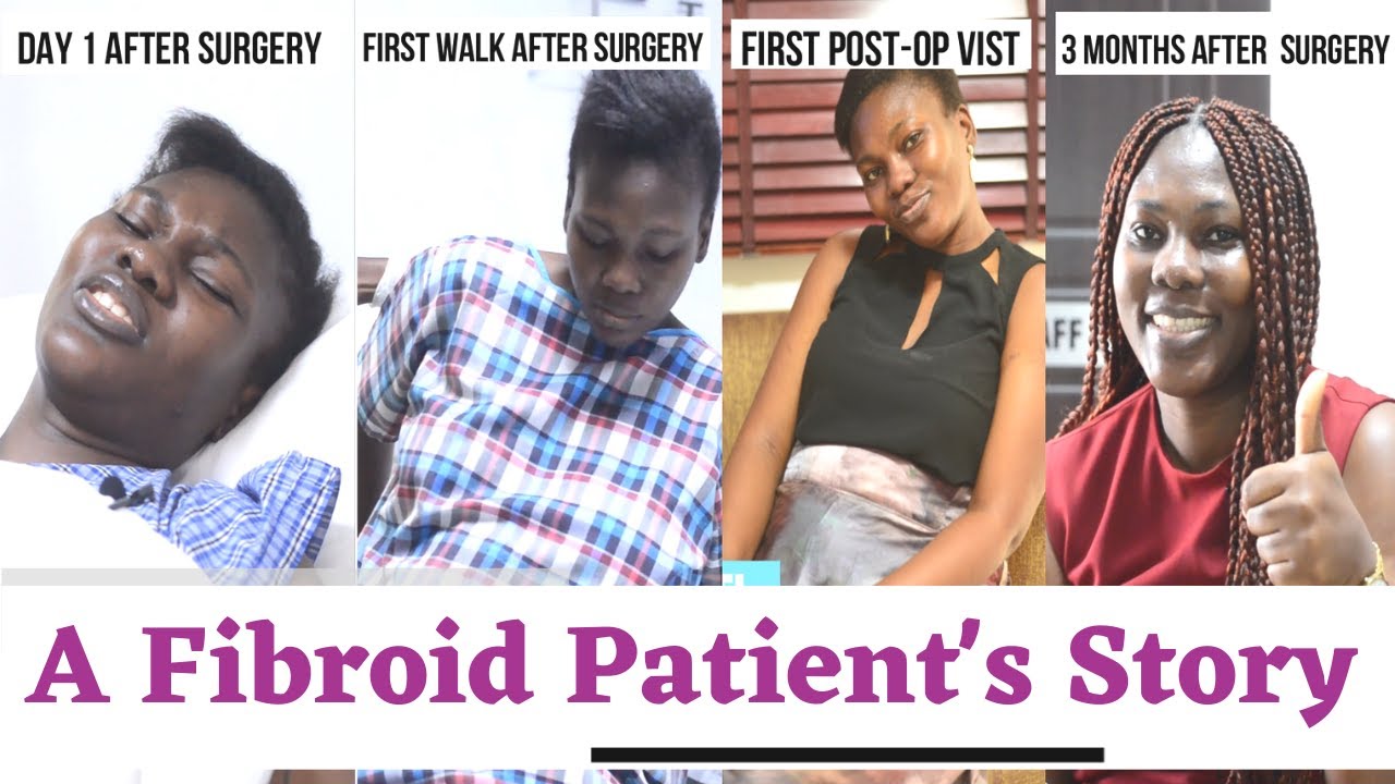 Fibroid Surgery at South Shore | Titi's Story