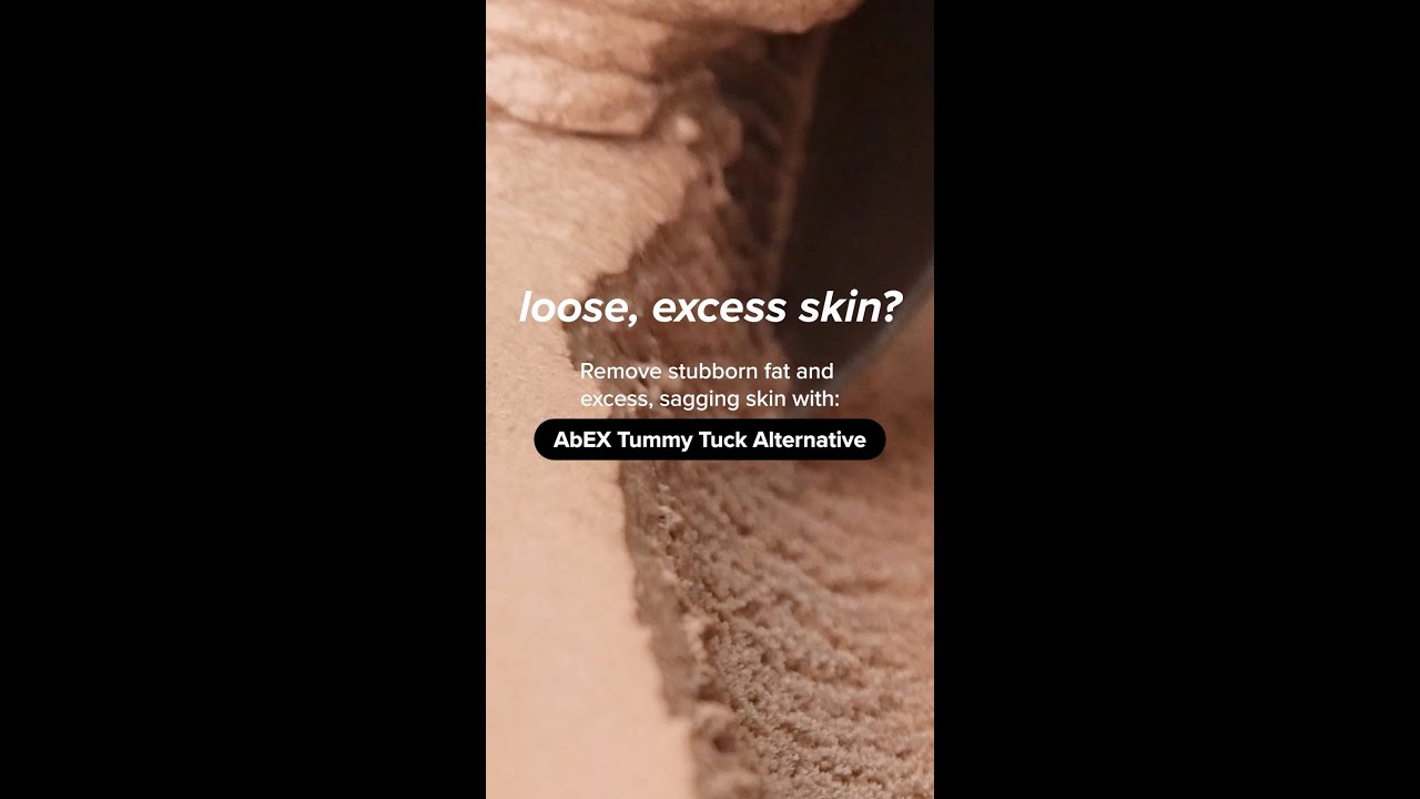 AbEX Tummy Tuck Alternative