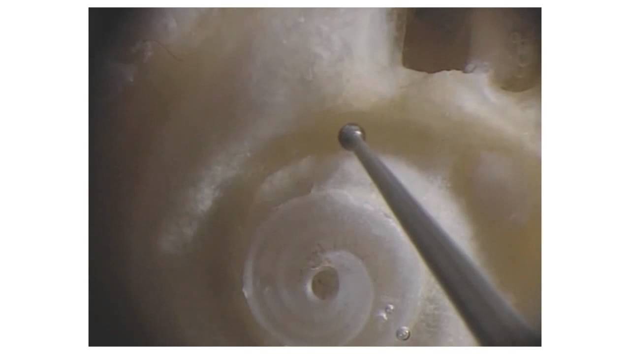 Acland Anatomy Podcast, Featuring New Inner Ear Videos
