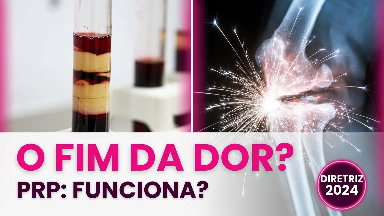 PRP: Cura milagrosa ou ferramenta de tratamento? A verdade científica.