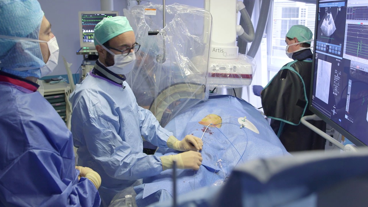Indications et résultats de l'ablation de FA