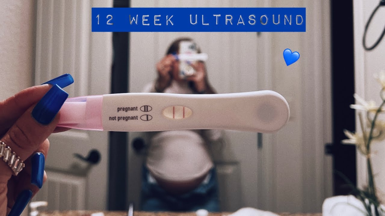 12 WEEK ULTRASOUND | GENDER CONFIRMED