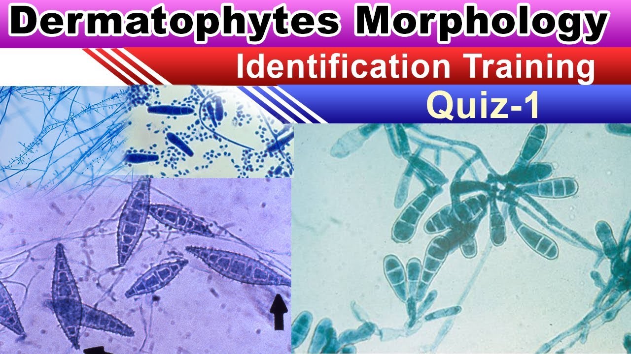 Dermatophytes Morphology  Identification Quiz   1