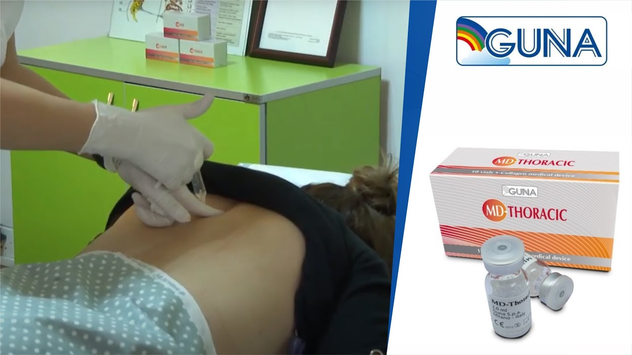 Guna Collagen Tibbi Vasitələri | MD-THORACIC - onurğa sütununun döş nahiyəsinin problemlərində