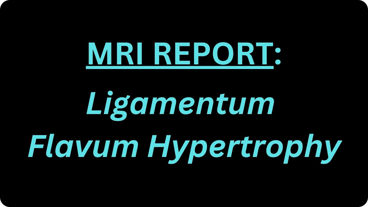 What is Ligamentum Flavum Hypertrophy?