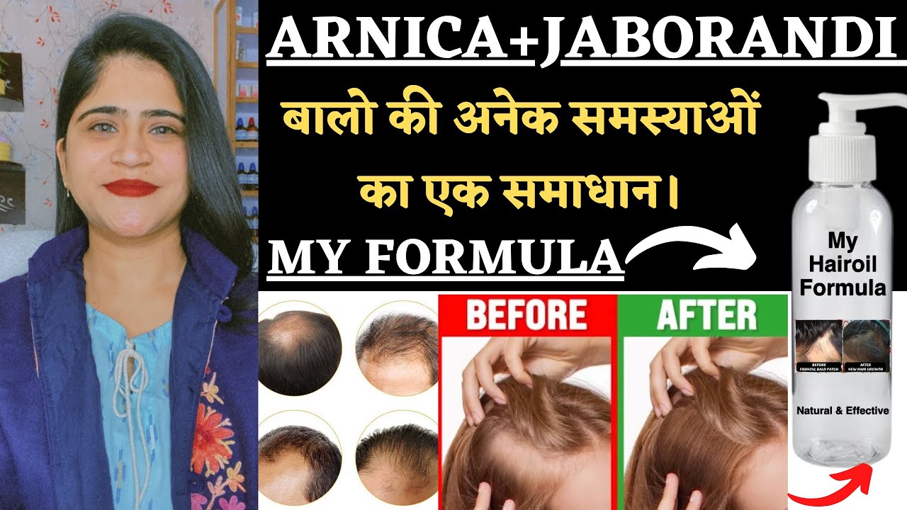 Jaborandi +Arnica Hairoil for All Hair Problems॥ My Formula || 100% Effective in Baldness & Hairfall