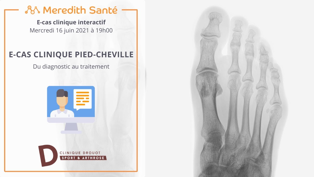 Les E-Cas Clinique de Drouot : CAS CLINIQUE PIED-CHEVILLE #2