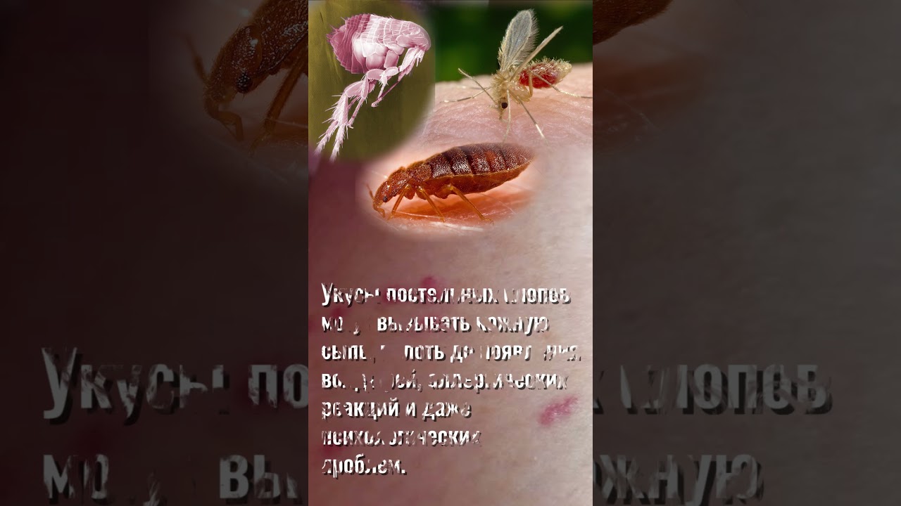 Кто вас ночью покусал: 🩸КЛОПЫ? Мошки? Блохи? Москиты-паппатачи? #укусынасекомых #москиты #мокрецы