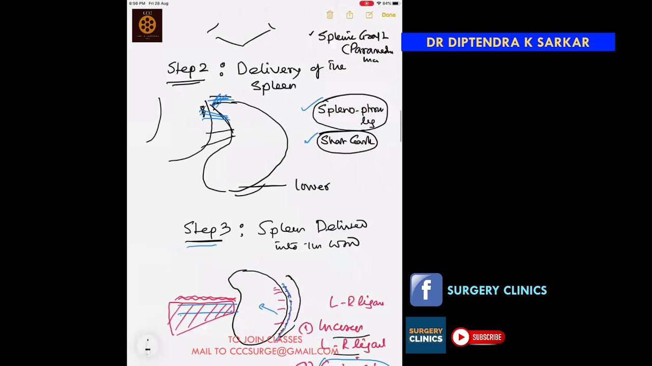 CCC Anatomy & Operations - Splenectomy - Diptendra Sarkar