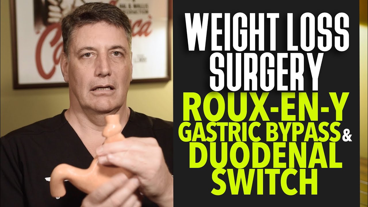 Ep:34 Weight Loss Surgery: Roux-en-Y Gastric Bypass and Duodenal Switch