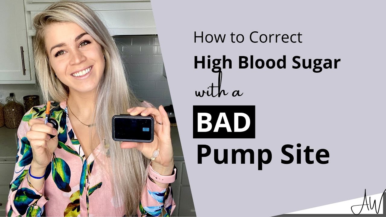 How to Correct High Blood Sugar with a BAD Pump Site