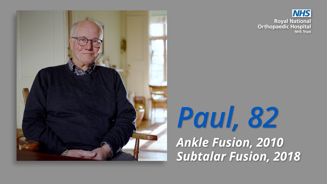 Paul, 82 - Ankle Fusion Patient in 2010 & Subtalar Fusion in 2018