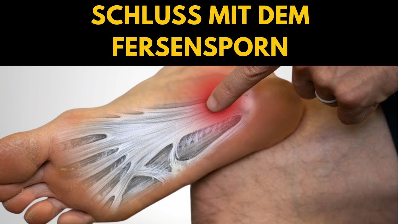 WIE HABE ICH MEINEN FERSENSPORN OHNE OPERATION GEHEILT?