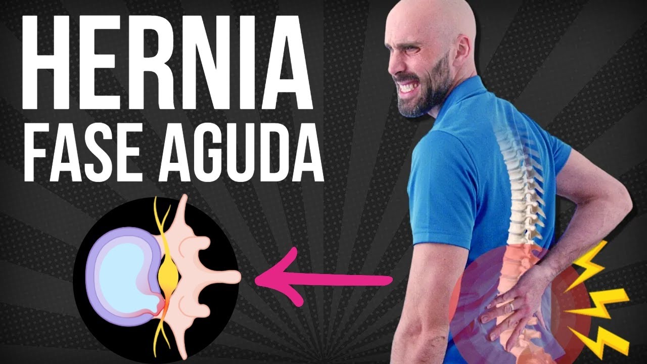 5 EJERCICIOS para HERNIA DISCAL si tienes dolor intenso