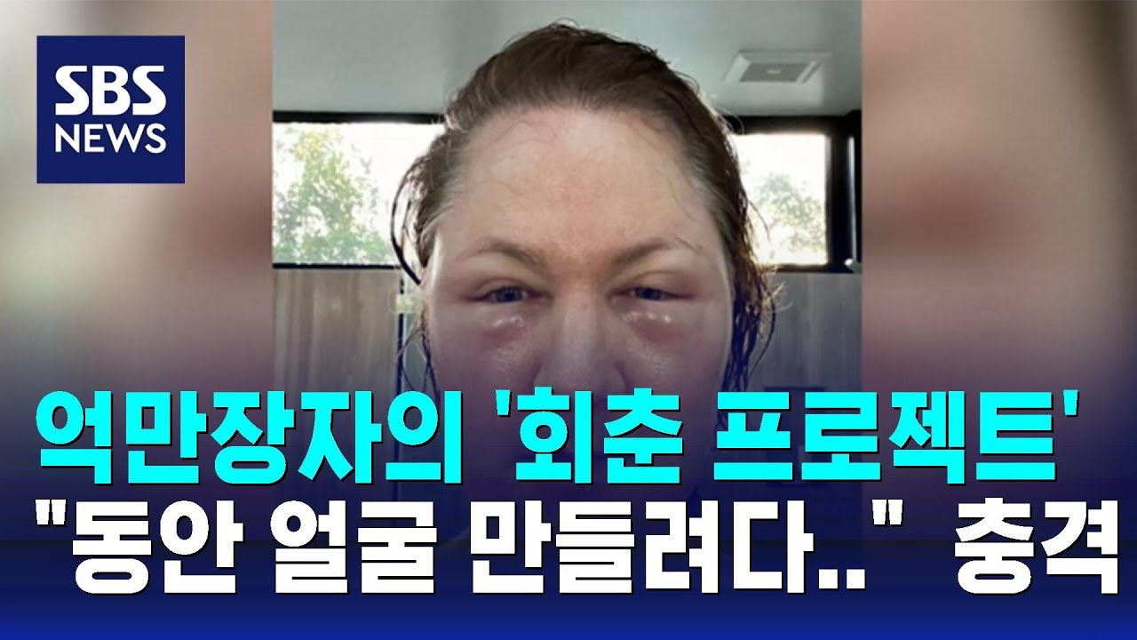 억만장자의 '회춘 프로젝트'&hellip;
