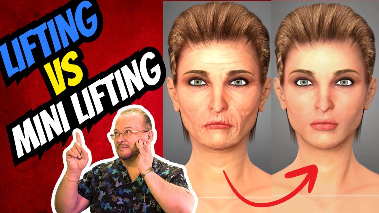 ¿Mini lifting o lifting facial? Descubre cuál te conviene