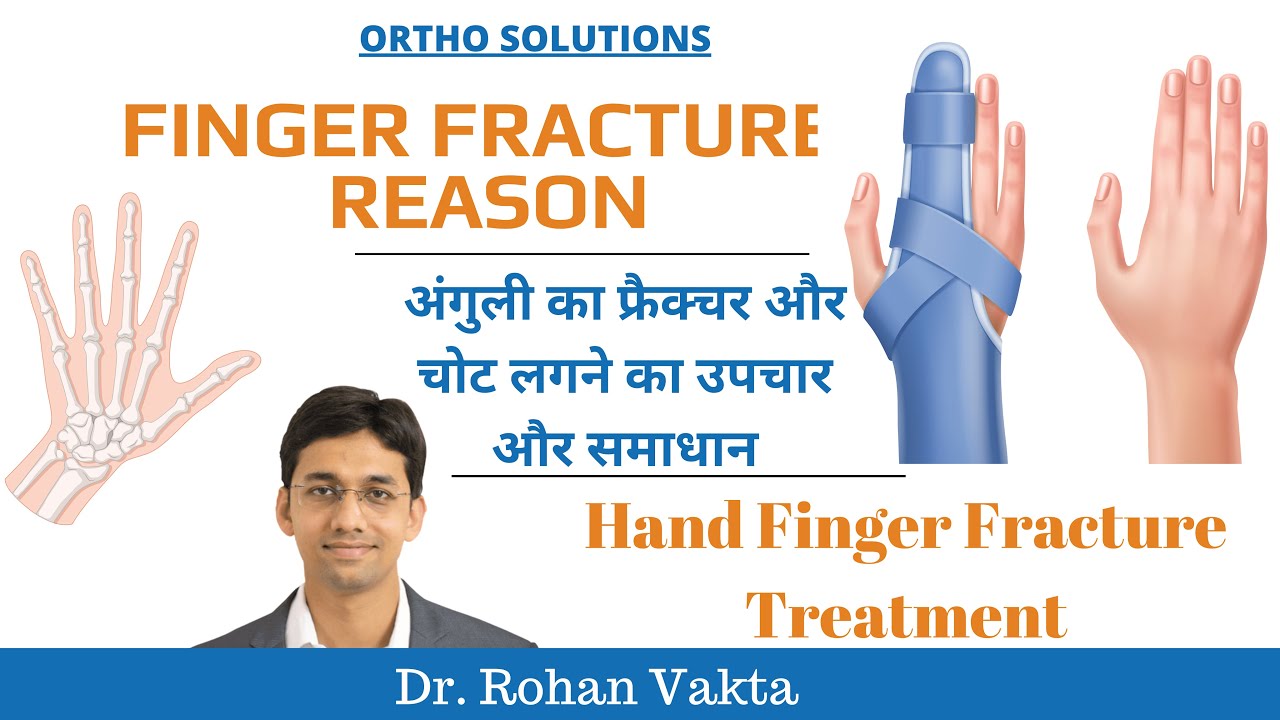 Finger Fracture Reason | अंगुली का फ्रैक्चर और चोट लगने का उपचार और समाधान | Hand Finger Fracture