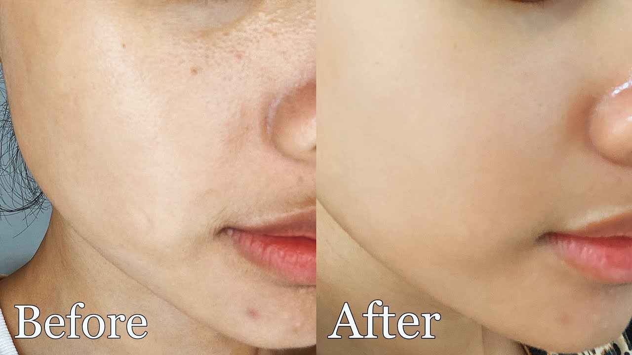 PENTING NYA EKSFOLIASI UNTUK KULIT + REKOMENDASI PRODUK UNTUK PEMULA ⎮ALL ABOUT EXFOLIATING