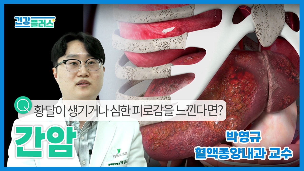 [건강플러스] 황달이 생기거나 심한 피로감을 느낀다면? | 간암 | 26년 2월 28일