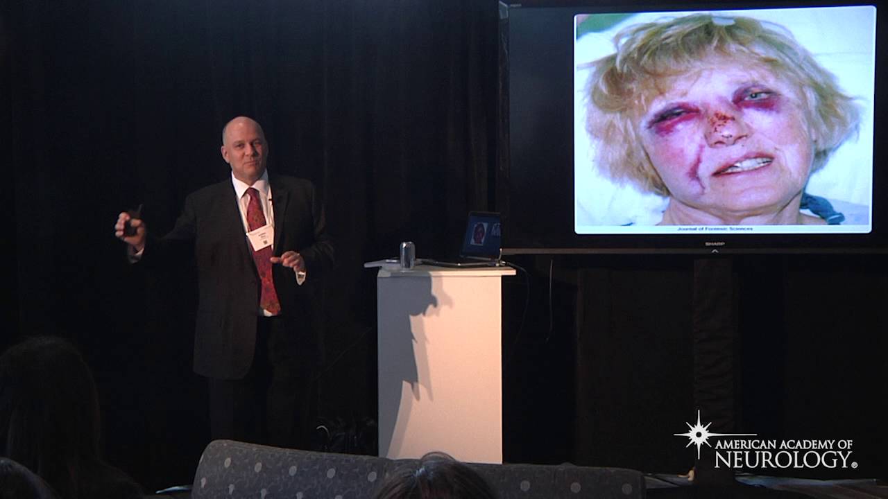 NeuroLearn: REM Sleep Behavior Disorder: There Will Be Plaque - American Academy of Neurology