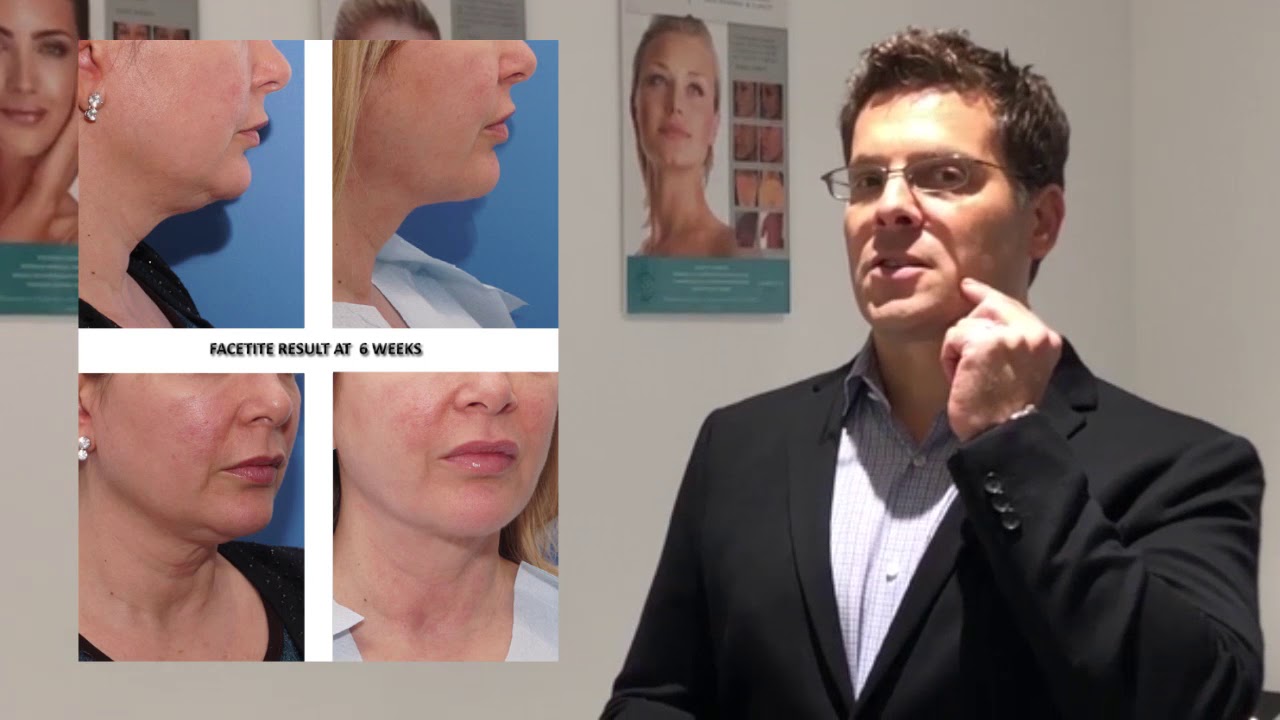 Dr Westreich discusses minimally invasive Facetite and other non-invasive alternatives