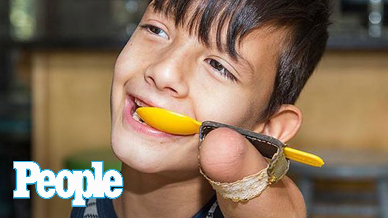 The Inspiring Story of a Family Who Adopted a Boy with No Arms and Legs | People