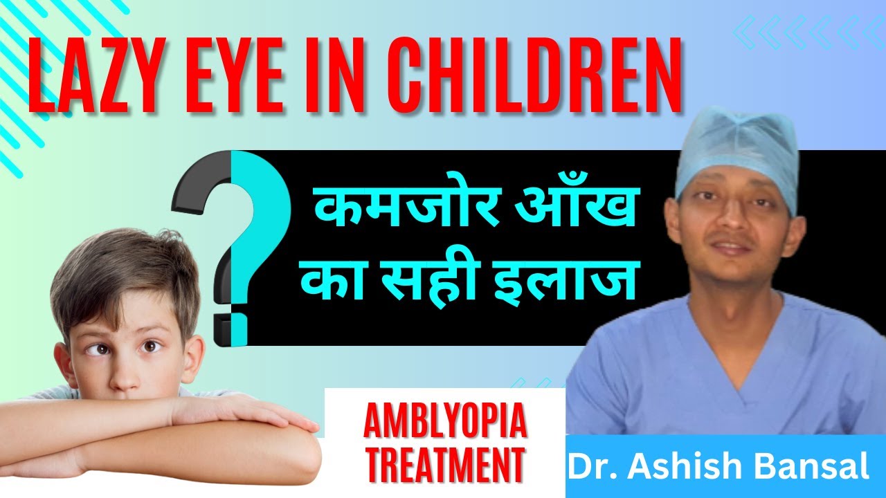 कमजोर आँख का सही इलाज Amblyopia treatment | Is your child suffering from Lazy Eye?