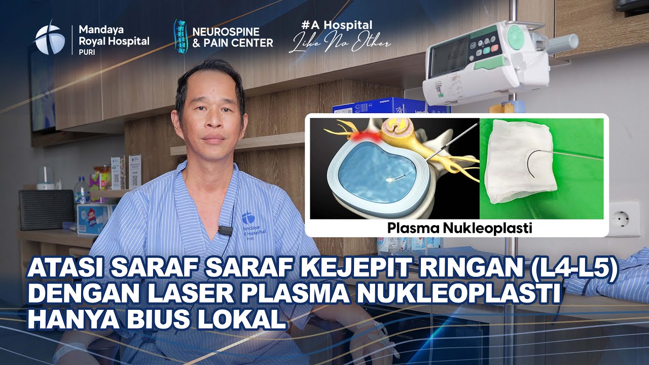 Pengobatan Saraf Kejepit Ringan L4-L5 Dengan Laser Plasma Nuclueoplasty | dr.Christian Ariono, Sp,BS
